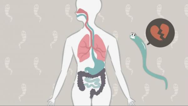 你知不知道寄生蟲感染如何影響神經(jīng)認知？